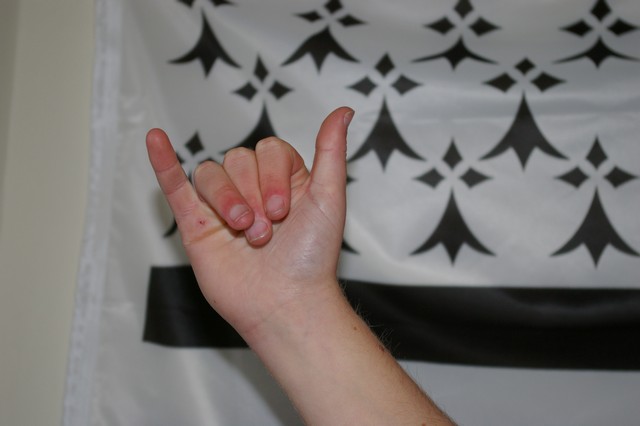 signe de Perig